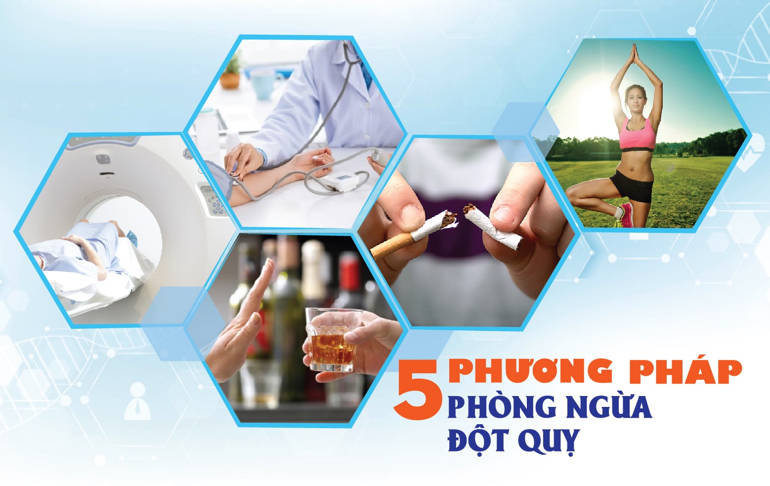 Phòng ngừa đột quỵ cùng Hà Nội Homecare